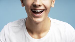 Excited, smiling boy with orthodontic braces, open mouth standing isolated on blue background, closeup. Concept of dental, treatment, health care