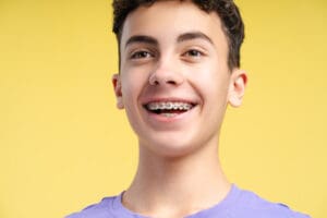 Portrait of smiling curly haired boy with dental braces looking away isolated on yellow background. Health care, orthodontic concept