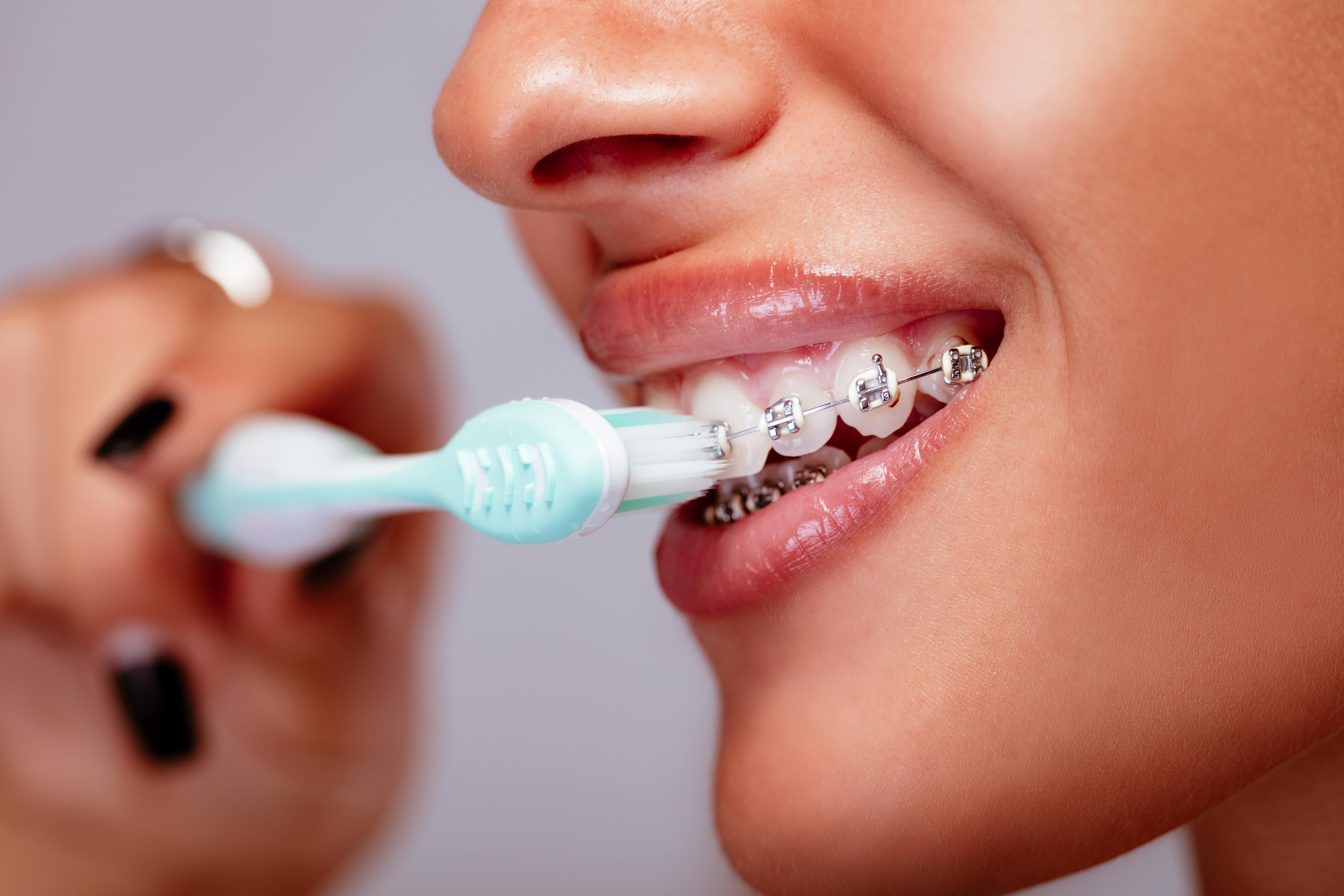 brushing-teeth-with-braces-2024-10-21-18-11-55-utc-min