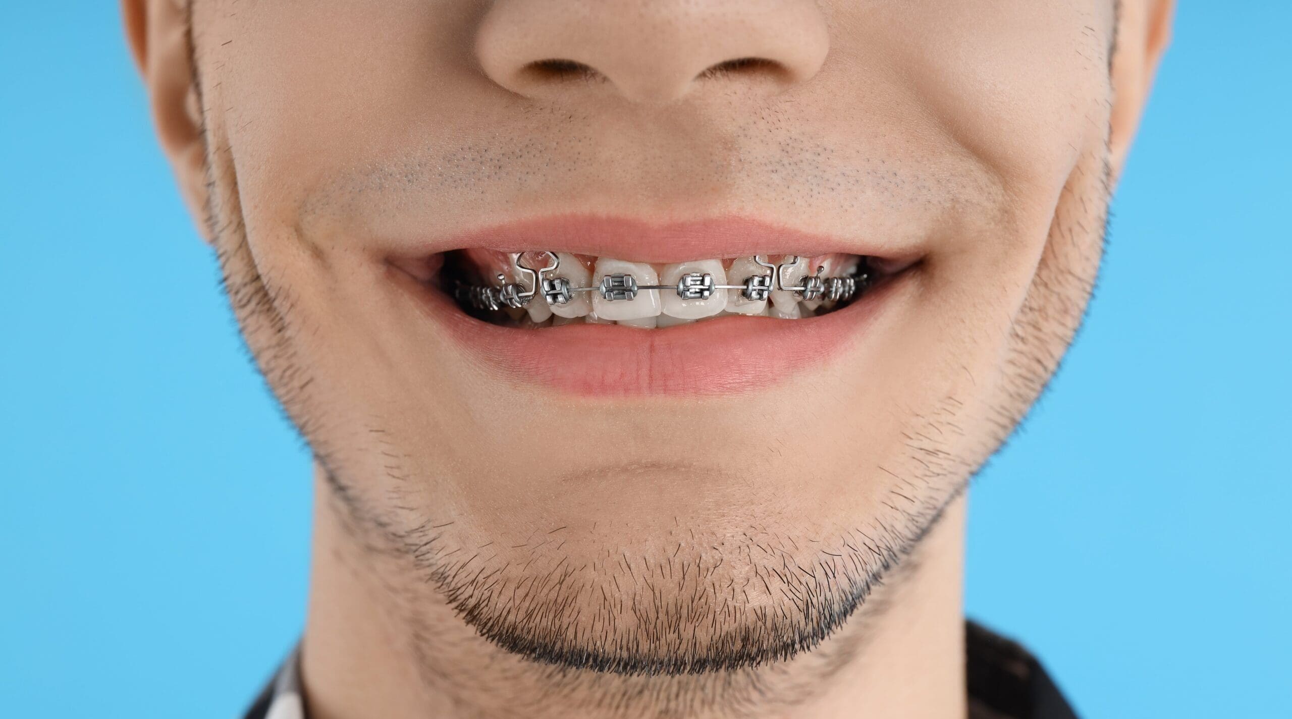 guy-with-braces-on-blue-background-close-up-2025-03-24-16-11-26-utc-min